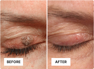 NutriDerma Gaurd buy